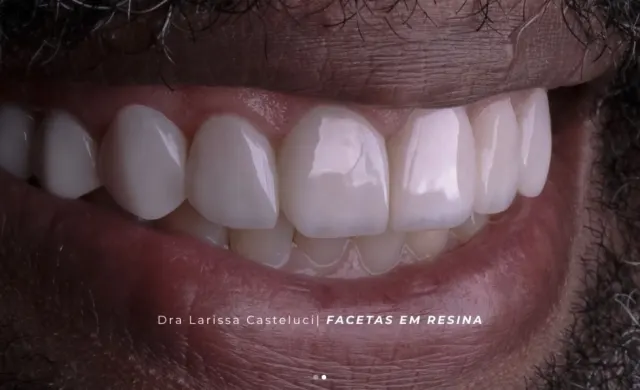 Sorriso depois da transformação 01