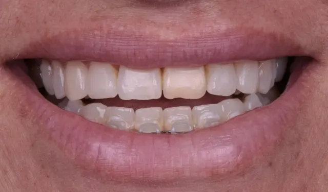 Sorriso antes da transformação 06